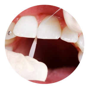 Dental Corporativa - Dentistas en Aguascalientes - Servicios1